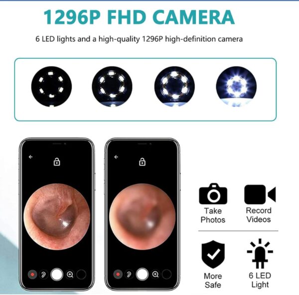 واي فاي أداة تنظيف الأذن البصرية إن إي 3 برو أسود